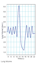 Load image into Gallery viewer, PASCO - Wireless Spirometer