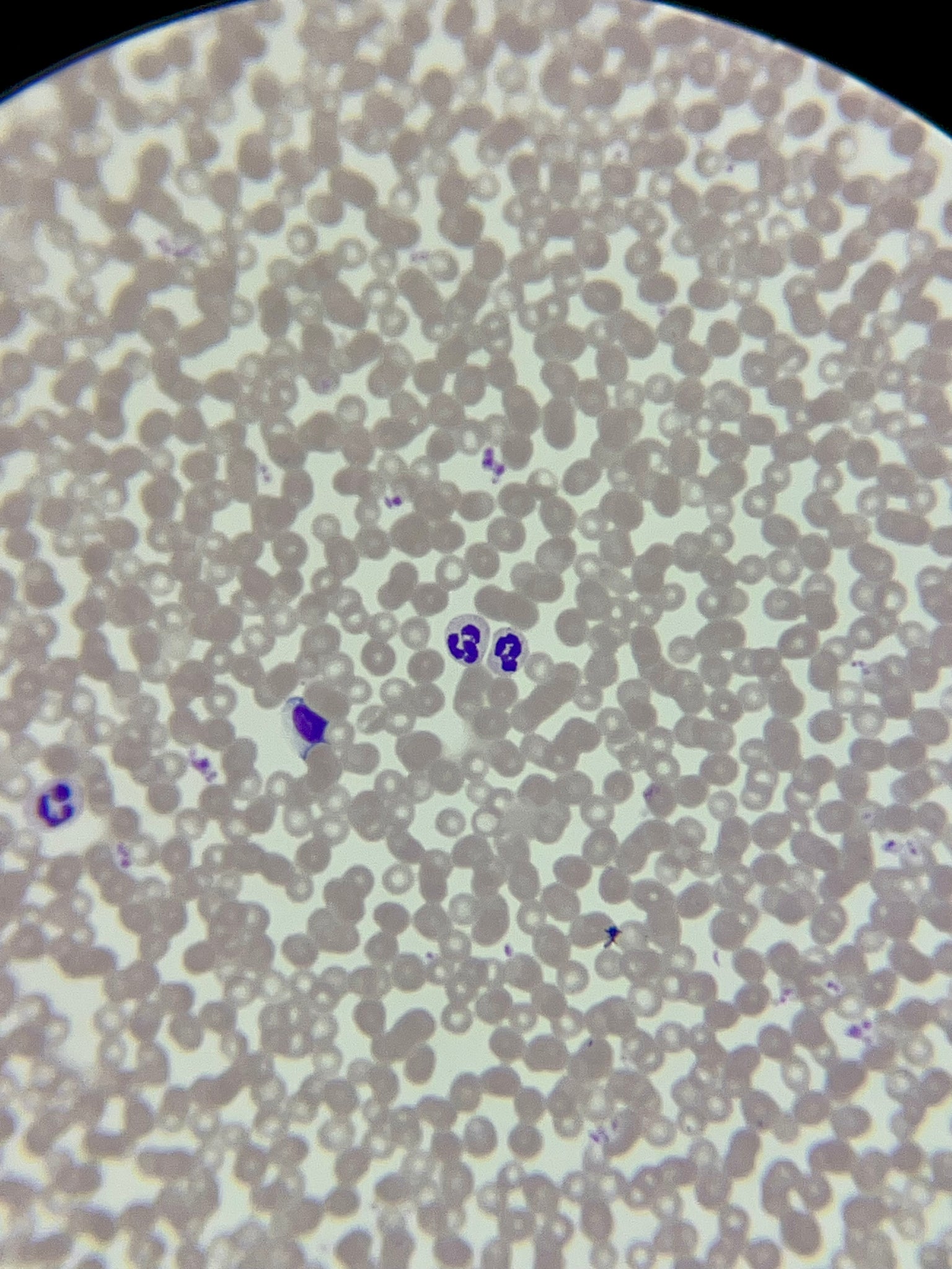 Wraight Stain Human Blood Wright Stain Prepared Microscope Slide HC1-40 – Science ...
