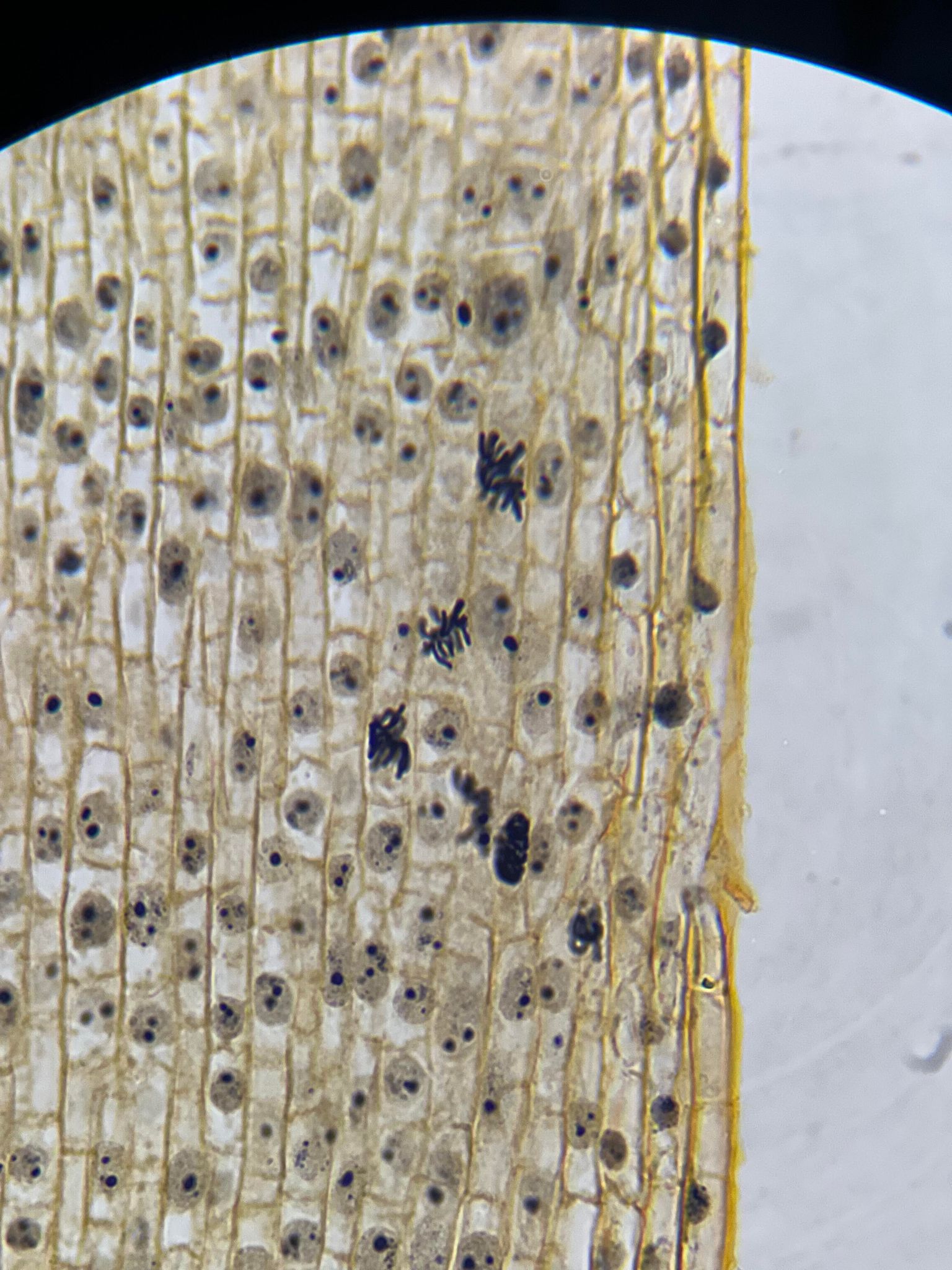 Onion Root Cells 10.3.1: Interphase, Mitosis, And Cytokinesis